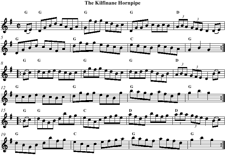 The Kilfinane Hornpipe